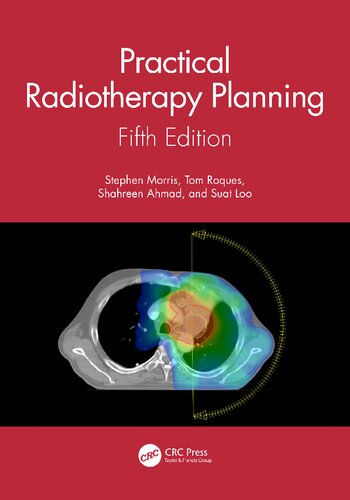 Practical Radiotherapy Planning: