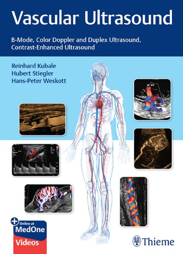 Vascular Ultrasound: B-Mode, Color Doppler and Duplex Ultrasound, Contrast-Enhanced Ultrasound [Team-IRA] (True PDF)