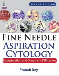 Fine Needle Aspiration Cytology: Interpretation and Diagnostic Difficulties