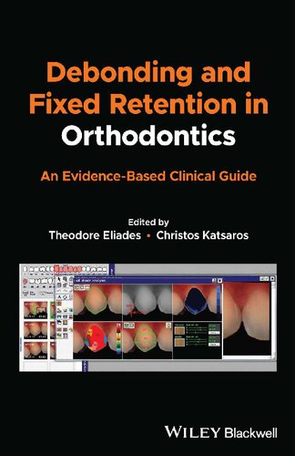 Debonding and Fixed Retention in Orthodontics: An Evidence-Based Clinical Guide [Team-IRA]