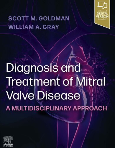 Diagnosis and Treatment of Mitral Valve Disease: A Multidisciplinary Approach [team-IRA]