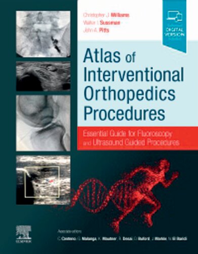 Atlas of Interventional Orthopedics Procedures: Essential Guide for Fluoroscopy and Ultrasound Guided Procedures