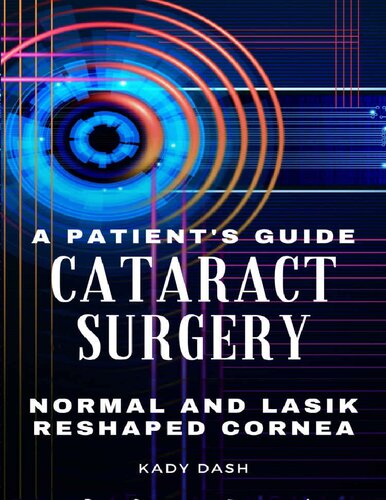 A Patient's Guide to Cataract Surgery: Normal and LASIK Reshaped Cornea