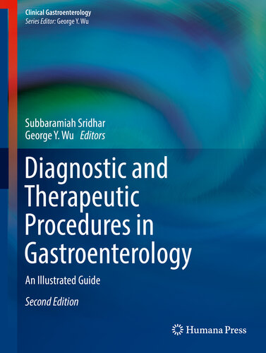 Diagnostic and Therapeutic Procedures in Gastroenterology: An Illustrated Guide (Clinical Gastroenterology)