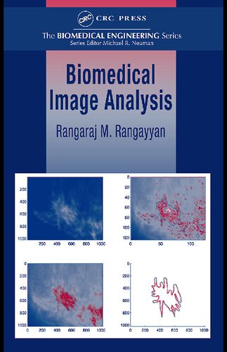 Biomedical Image Analysis (Biomedical Engineering)