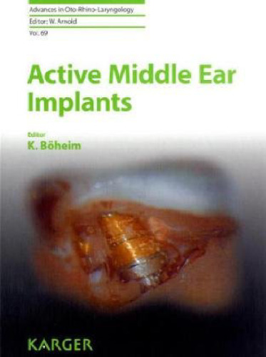 Active Middle Ear Implants (Advances in Oto-Rhino-Laryngology, Vol. 69)