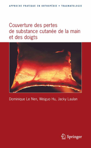 Approche pratique de la couverture des pertes de substance cutanee de la main et des doigts (Approche pratique en orthopedie-traumatologie)