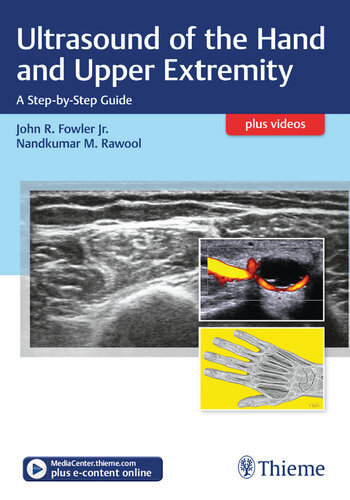 Ultrasound of the Hand and Upper Extremity: A Step-By-Step Guide