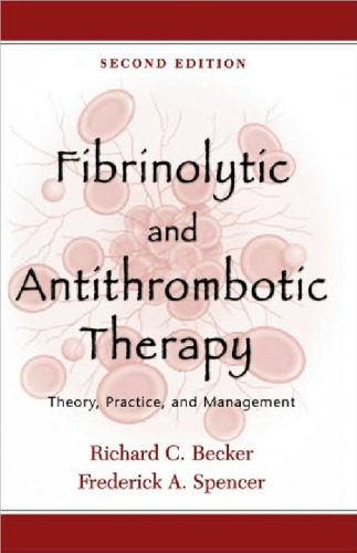 Fibrinolytic and Antithrombotic Therapy: Theory, Practice, and Management, Second Edition