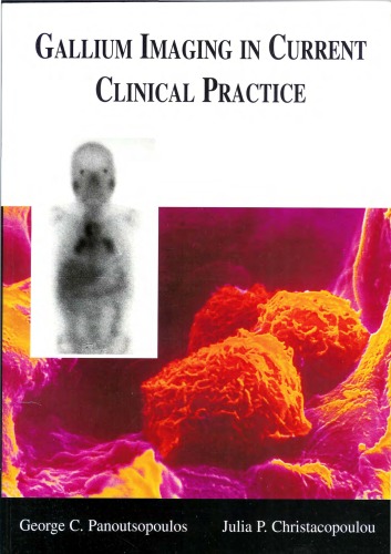 Gallium Imaging In Current Clinical Practice