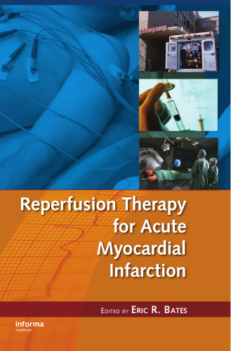 Reperfusion Therapy for Acute Myocardial Infarction (Fundamental and Clinical Cardiology)