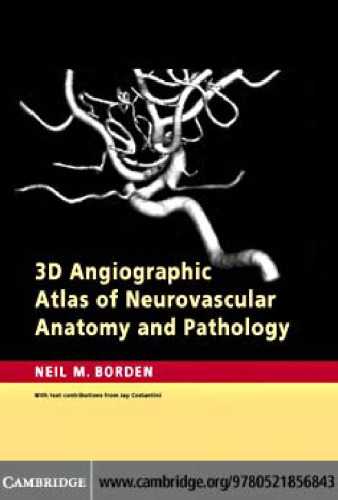 3D Angiographic Atlas of Neurovascular Anatomy and Pathology