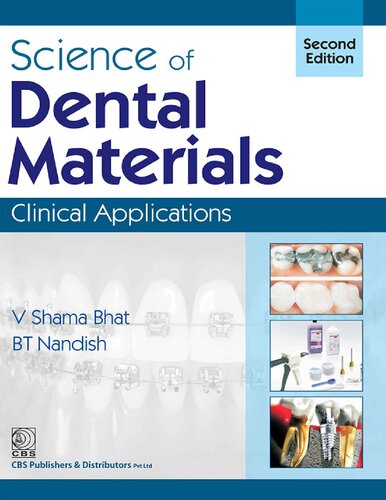 Science of Dental Materials: Clinical Applications