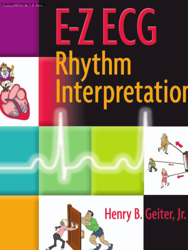 E-Z ECG Rhythm Interpretation