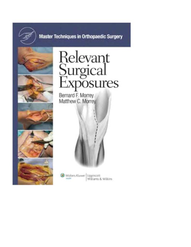 Master Techniques in Orthopaedic Surgery: Relevant Surgical Exposures (Master Techniques in Orthopaedic Surgery)