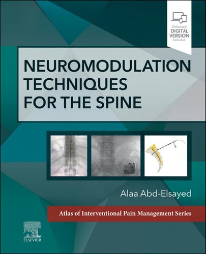 Neuromodulation Techniques for the Spine - E-Book: A Volume in the Atlas of Interventional Pain Management Series