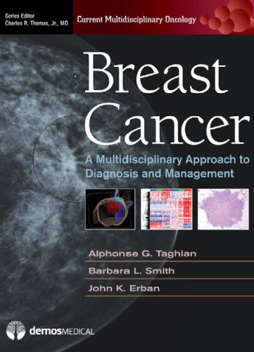 Breast Cancer: A Multidisciplinary Approach to Diagnosis and Managmenet (Current Multidisciplinary Oncology Series)