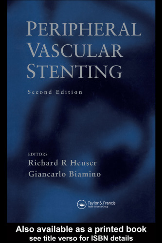 Peripheral Vascular Stenting: Second Edition