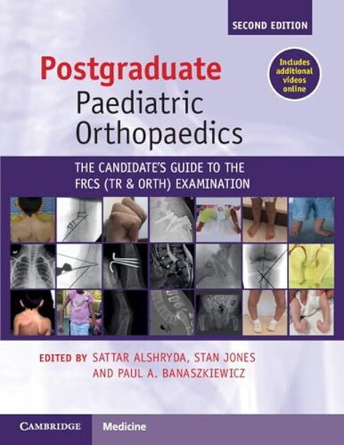 Postgraduate Paediatric Orthopaedics: The Candidate's Guide to the FRCS (Tr&Orth) Examination