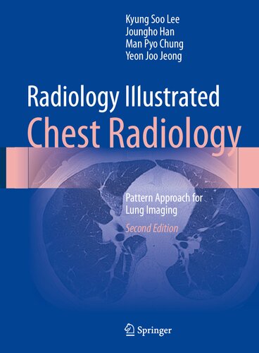 Radiology Illustrated - Chest Radiology - Pattern Approach for Lung Imaging, 2e (Feb 10, 2024)_(9819966329)_(Springer)