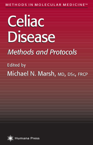 Celiac Disease: Methods and Protocols (Methods in Molecular Medicine)