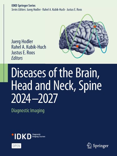 Diseases of the Brain, Head and Neck, Spine 2024-2027: Diagnostic Imaging (IDKD Springer Series)