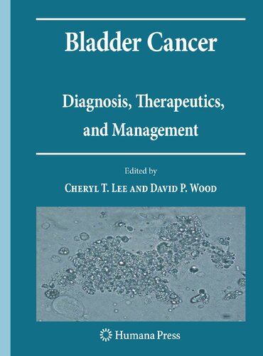 Bladder Cancer: Diagnosis, Therapeutics, and Management (Current Clinical Urology)