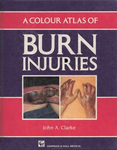 A Colour Atlas of Burn Injuries (Chapman & Hall Medical Atlas Series, 9)