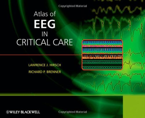 Atlas of EEG in Critical Care