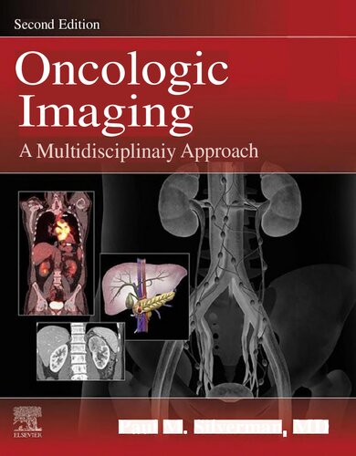 Oncologic Imaging: A Multidisciplinary Approach