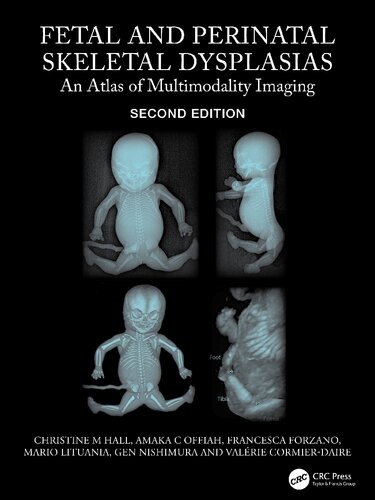 Fetal and Perinatal Skeletal Dysplasias: An Atlas of Multimodality Imaging