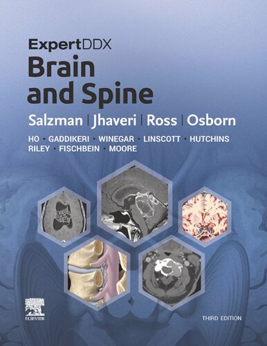 ExpertDDx: Brain and Spine