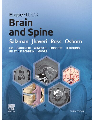 ExpertDDx - Brain and Spine, 3e (Apr 25, 2023)_(0443106940)_(Elsevier).pdf