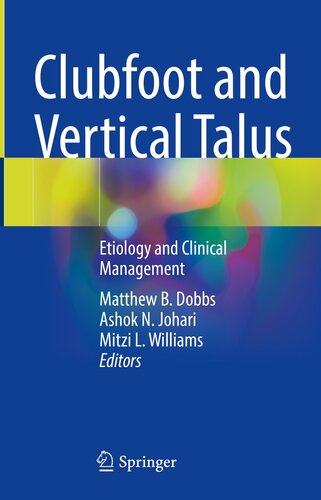 Clubfoot and Vertical Talus : Etiology and Clinical Management