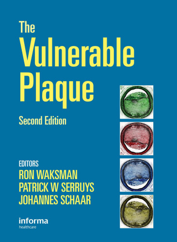 The Vulnerable Plaque, Second Edition