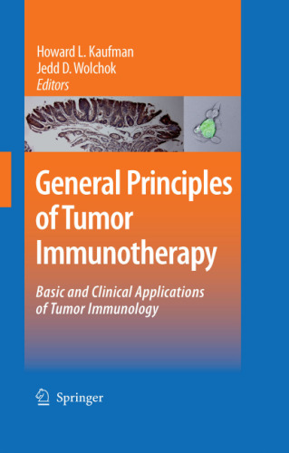 General Principles of Tumor Immunotherapy: Basic and Clinical Applications of Tumor Immunology