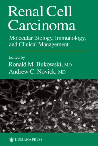 Renal Cell Carcinoma: Molecular Biology, Immunology, and Clinical Management (Current clinical Oncology)