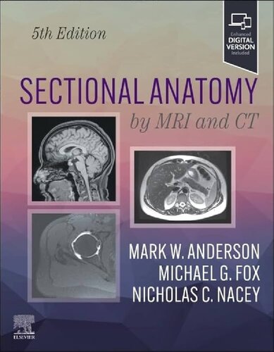 Sectional Imaging by MRI and CT - Radiology Imaging 5th edition