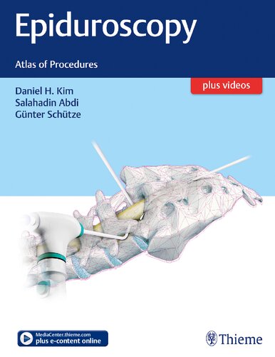 Epiduroscopy: Atlas of Procedures