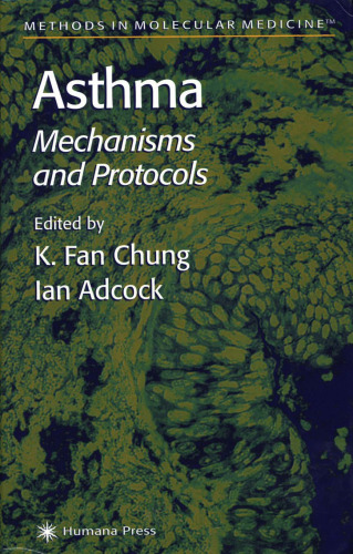 Asthma Mechanisms and Protocols (Methods in Molecular Medicine No 44)