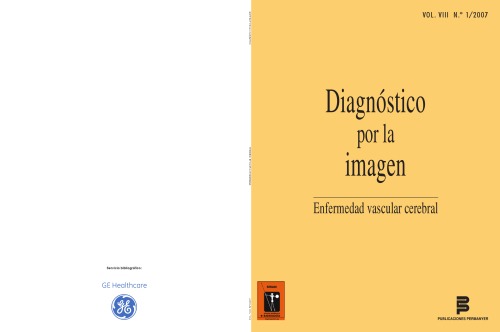 Diagnostico por la imagen: Enfermedad cerebral vascular