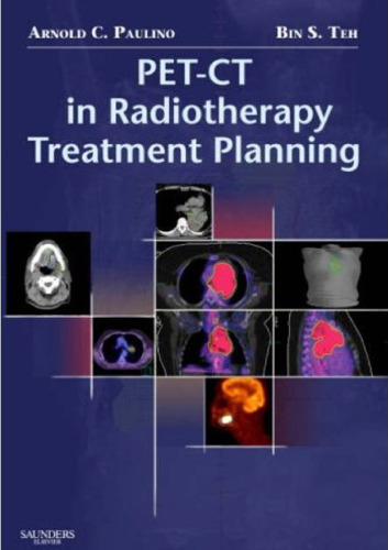 PET-CT in Radiotherapy Treatment Planning