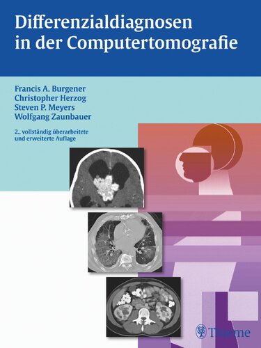 Differenzialdiagnosen in der Computertomografie