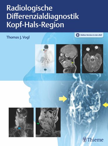 Radiologische Differenzialdiagnostik Kopf-Hals-Region