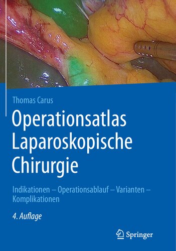 Operationsatlas Laparoskopische Chirurgie: Indikationen - Operationsablauf - Varianten - Komplikationen