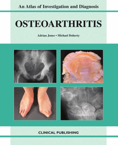 Oesteoarthritis: An Atlas of Investigation and Diagnosis