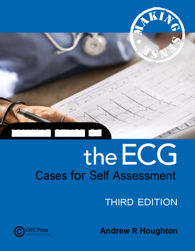 Making Sense of the ECG: Cases for Self Assessment