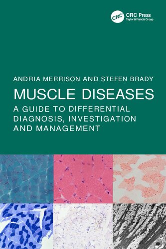 Muscle Diseases: A Guide to Differential Diagnosis, Investigation and Management