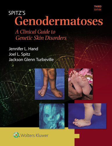 Spitz's Genodermatoses - A Full Color Clinical Guide to Genetic Skin Disorders, 3e (May 25, 2024)_(1451116519)_(LWW).epub