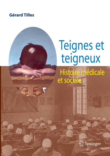 Teignes et teigneux: Histoire medicale et sociale (French Edition)